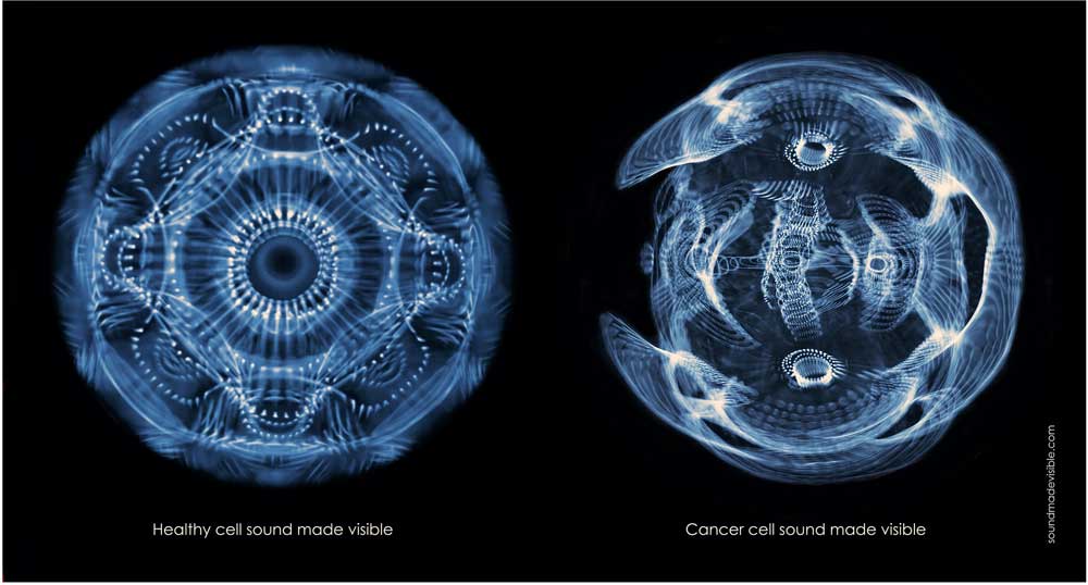 healthy cell vs cancer cell Public Resource Page for New Gaia TV Series Vesica Institute for Holistic Studies