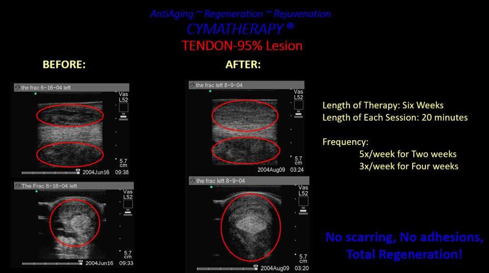 antiaging regeneration rejuvenation cymatherapy Cymatherapy: Restoring the Core Resonant Frequency to <br>Heal Body Organs & the Human Structural Energy Field<br> Part 3 of the 2023 Resource Guide Vesica Institute for Holistic Studies
