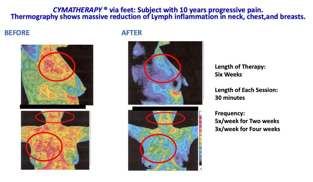 cymatherapy breast scan 1 Cymatherapy: Restoring the Core Resonant Frequency to <br>Heal Body Organs & the Human Structural Energy Field<br> Part 3 of the 2023 Resource Guide Vesica Institute for Holistic Studies