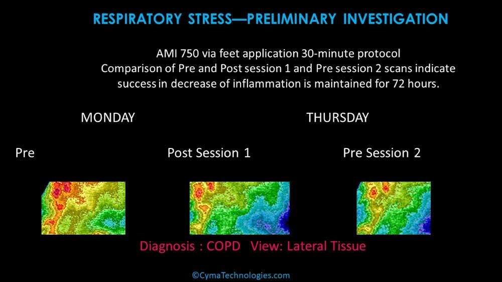 respiratory stress scan Cymatherapy: Restoring the Core Resonant Frequency to <br>Heal Body Organs & the Human Structural Energy Field<br> Part 3 of the 2023 Resource Guide Vesica Institute for Holistic Studies
