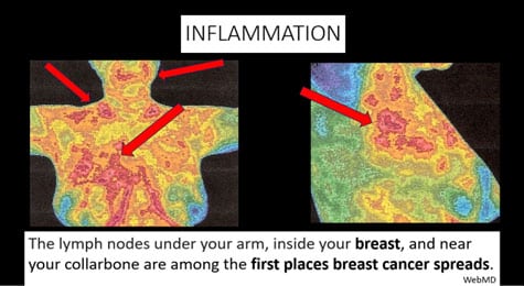 Inflammation lymph nodes e1689255188214 Many People Ask: Frequently Ask Cymatherapy Questions Vesica Institute for Holistic Studies