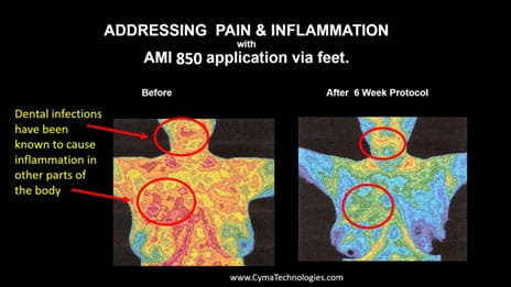 addressing pain and inflation thermal image Many People Ask: Frequently Ask Cymatherapy Questions Vesica Institute for Holistic Studies