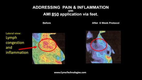addressing pain and inflation thermal images Many People Ask: Frequently Ask Cymatherapy Questions Vesica Institute for Holistic Studies