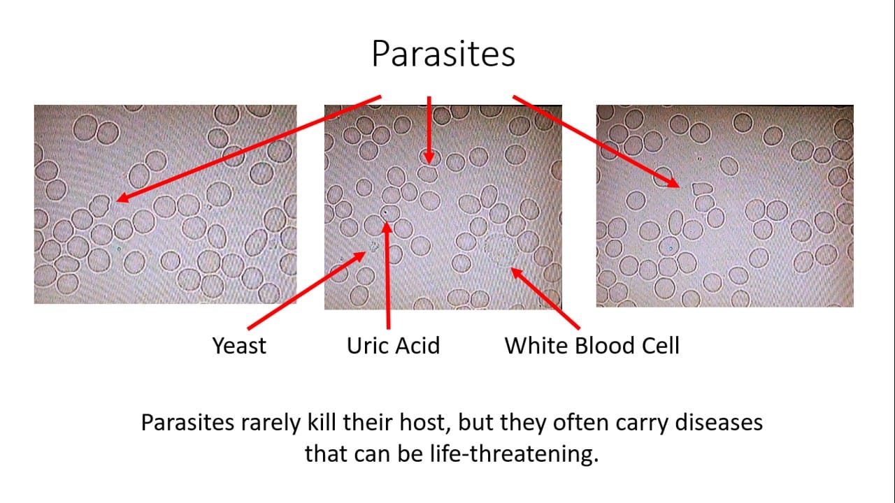 Parasites Recent Report of Live Blood Analysis Results with Cymatherapy Vesica Institute for Holistic Studies